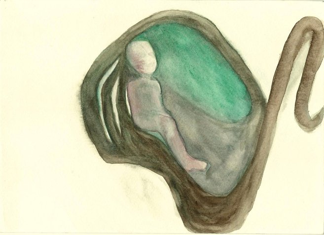  18x25 cm